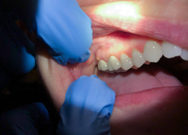 Best Pediatric Emergency Dentist in Round Rock, TX